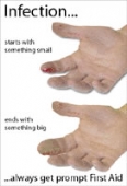 infection infection